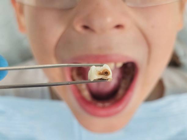 Best Walk-In Emergency Dentist in Archer Lodge, NC
