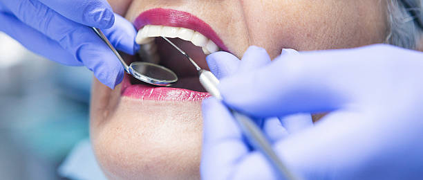 Best Emergency Wisdom Teeth Removal in Archer Lodge, NC
